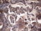 Matrix Metallopeptidase 7 antibody, LS-C790400, Lifespan Biosciences, Immunohistochemistry paraffin image 