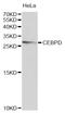 CCAAT Enhancer Binding Protein Delta antibody, abx007205, Abbexa, Western Blot image 