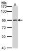 Minichromosome Maintenance Complex Component 7 antibody, GTX110278, GeneTex, Western Blot image 
