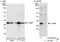 Complement component 1 Q subcomponent-binding protein, mitochondrial antibody, A302-862A, Bethyl Labs, Western Blot image 