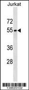 Septin 6 antibody, 60-054, ProSci, Western Blot image 