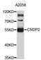 Carnosine Dipeptidase 2 antibody, STJ111233, St John