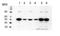 Estrogen Receptor 2 antibody, ab3576, Abcam, Western Blot image 