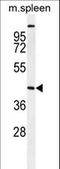 Serine/Threonine Kinase 32A antibody, LS-C161561, Lifespan Biosciences, Western Blot image 