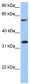 Testis Specific Serine Kinase Substrate antibody, TA335490, Origene, Western Blot image 