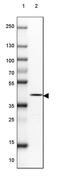 Inositol-Trisphosphate 3-Kinase A antibody, PA5-59185, Invitrogen Antibodies, Western Blot image 