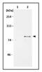 Minichromosome Maintenance Complex Component 7 antibody, GTX00894, GeneTex, Immunoprecipitation image 