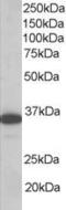 Linker For Activation Of T Cells antibody, LS-C20174, Lifespan Biosciences, Western Blot image 