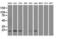 Adenylate Kinase 1 antibody, LS-C784166, Lifespan Biosciences, Western Blot image 