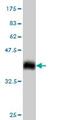 F2R Like Thrombin Or Trypsin Receptor 3 antibody, ab56359, Abcam, Western Blot image 