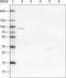 Cysteinyl-TRNA Synthetase antibody, MA5-24635, Invitrogen Antibodies, Western Blot image 