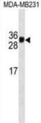 Kallikrein Related Peptidase 3 antibody, abx025470, Abbexa, Western Blot image 