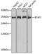 TATA-binding protein-associated factor 172 antibody, GTX30095, GeneTex, Western Blot image 