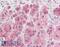 Zinc Finger E-Box Binding Homeobox 2 antibody, 42-432, ProSci, Enzyme Linked Immunosorbent Assay image 