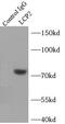 Lymphocyte Cytosolic Protein 2 antibody, FNab07988, FineTest, Immunoprecipitation image 