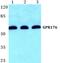 G Protein-Coupled Receptor 176 antibody, PA5-75518, Invitrogen Antibodies, Western Blot image 