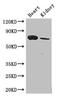 Mediator Complex Subunit 17 antibody, CSB-PA865147LA01HU, Cusabio, Western Blot image 