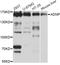 Activity Dependent Neuroprotector Homeobox antibody, A4546, ABclonal Technology, Western Blot image 