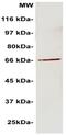 Protein LYRIC antibody, OAAI00784, Aviva Systems Biology, Western Blot image 