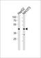 Nuclear Receptor Subfamily 2 Group F Member 2 antibody, PA5-35141, Invitrogen Antibodies, Western Blot image 