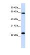 Karyopherin Subunit Alpha 1 antibody, NBP1-54603, Novus Biologicals, Western Blot image 