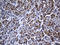 Fragile Histidine Triad Diadenosine Triphosphatase antibody, LS-C792785, Lifespan Biosciences, Immunohistochemistry paraffin image 