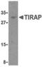 TIR Domain Containing Adaptor Protein antibody, orb86796, Biorbyt, Western Blot image 