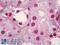 Protein Kinase, DNA-Activated, Catalytic Subunit antibody, LS-B6857, Lifespan Biosciences, Immunohistochemistry frozen image 