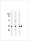 Cell Growth Regulator With EF-Hand Domain 1 antibody, TA325182, Origene, Western Blot image 