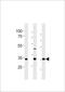 Cell Growth Regulator With EF-Hand Domain 1 antibody, TA325182, Origene, Western Blot image 