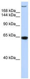 Trinucleotide Repeat Containing Adaptor 6A antibody, TA343900, Origene, Western Blot image 