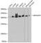 Rho GTPase Activating Protein 5 antibody, 19-096, ProSci, Western Blot image 