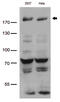 Bromodomain Adjacent To Zinc Finger Domain 1B antibody, CF812820, Origene, Western Blot image 