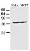 Casein Kinase 1 Alpha 1 antibody, GTX50020, GeneTex, Western Blot image 