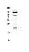 Hepatocellular carcinoma-associated protein TD26 homolog antibody, PA5-78777, Invitrogen Antibodies, Western Blot image 