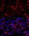 Histone Deacetylase 6 antibody, LS-C746922, Lifespan Biosciences, Immunofluorescence image 