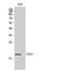 Tumor Suppressor 2, Mitochondrial Calcium Regulator antibody, A07508, Boster Biological Technology, Western Blot image 