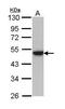 Keratin 31 antibody, GTX112530, GeneTex, Western Blot image 