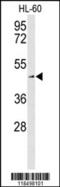 Solute Carrier Family 1 Member 5 antibody, 63-944, ProSci, Western Blot image 