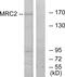 Myosin Light Chain 12A antibody, LS-C119298, Lifespan Biosciences, Western Blot image 
