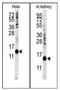 Cytidine Deaminase antibody, AP12535PU-N, Origene, Western Blot image 