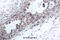Phosphatase And Tensin Homolog antibody, A00006-2, Boster Biological Technology, Immunohistochemistry paraffin image 
