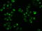 Adenylate Kinase 1 antibody, LS-C784195, Lifespan Biosciences, Immunofluorescence image 