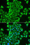Cysteinyl-TRNA Synthetase antibody, 22-297, ProSci, Immunofluorescence image 