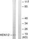 Nescient Helix-Loop-Helix 1 antibody, PA5-38654, Invitrogen Antibodies, Western Blot image 