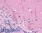 Protein Phosphatase 2 Scaffold Subunit Abeta antibody, LS-B751, Lifespan Biosciences, Immunohistochemistry paraffin image 