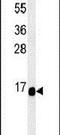 Regulator Of Hemoglobinization And Erythroid Cell Expansion antibody, PA5-25856, Invitrogen Antibodies, Western Blot image 