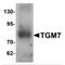 Transglutaminase 7 antibody, MBS150762, MyBioSource, Western Blot image 