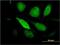 Pentraxin 3 antibody, H00005806-M02, Novus Biologicals, Immunocytochemistry image 