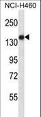 Toll Like Receptor 8 antibody, LS-C161923, Lifespan Biosciences, Western Blot image 